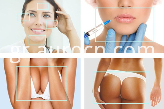 υαλουρονικό οξύ για αρθρώσεις hyaluronic acid for joints